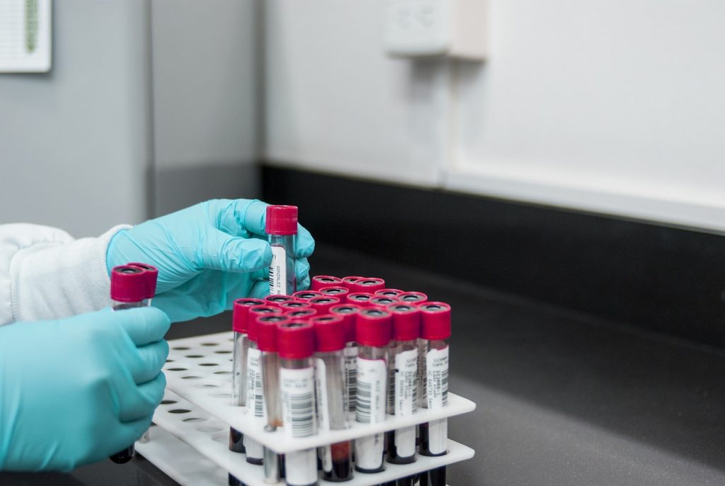 lab experiment