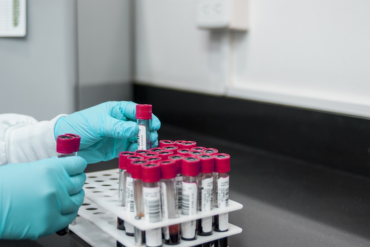 lab experiment