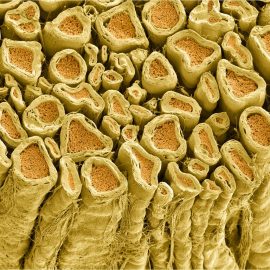 Chemotherapy-induced peripheral neurotoxicity (CIPN) Chemotherapy-induced peripheral neurotoxicity (CIPN)