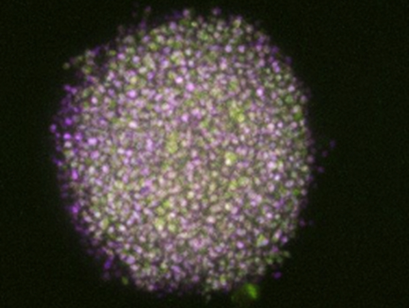 GBM neurosphere